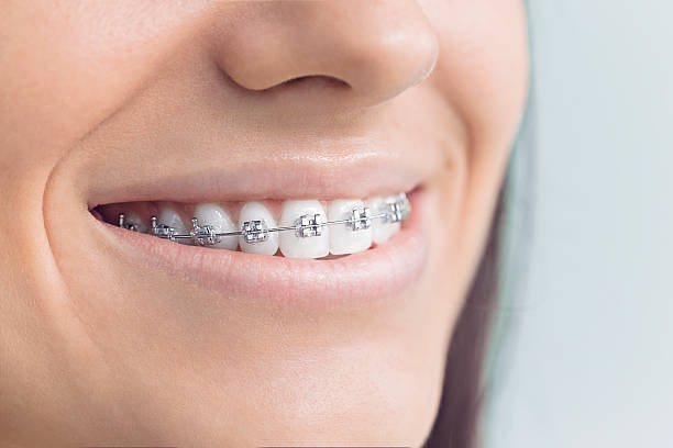 Best Invisalign and Clear Aligners  in Valdosta, GA